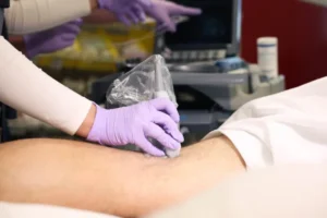 how ultrasound guided release works
